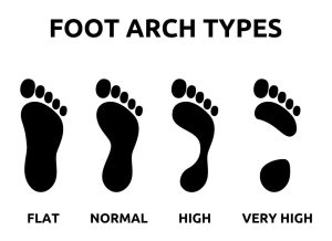Know Your Feet Type