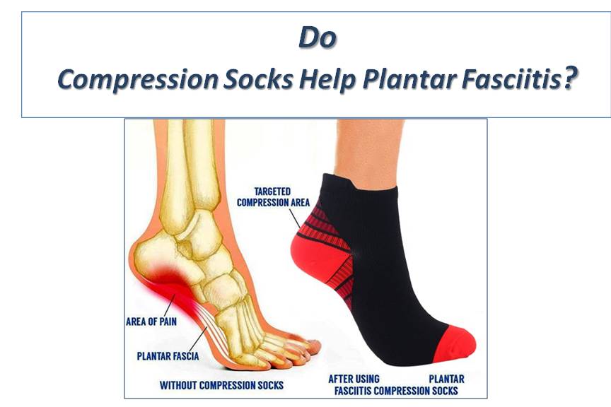 Do Compression Socks Help Plantar Fasciitis?