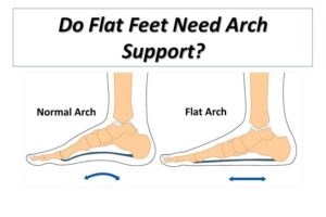 Do Flat Feet Need Arch Support